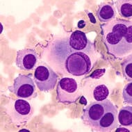 Melanoma Cancer Cells