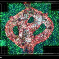 bioprinted tumor